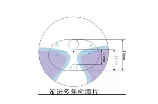 美麗島多焦鏡適合的人群，需要注意的事項